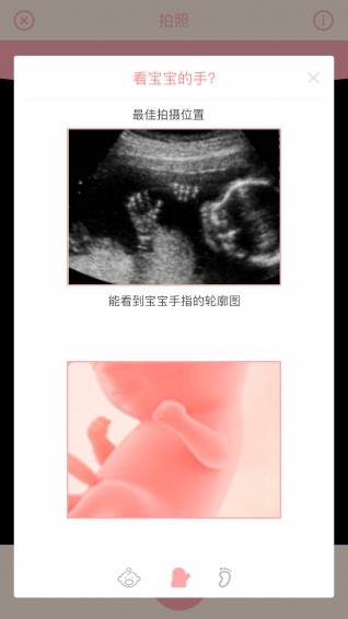胎儿相机手机版 v5.0 安卓版0