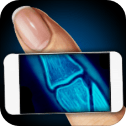 模拟器X射线手指笑话软件