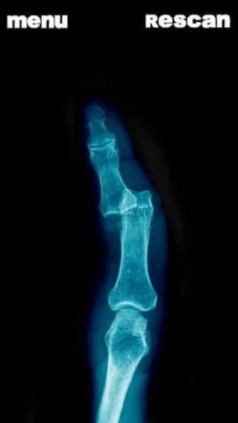 模拟器X射线手指笑话最新版