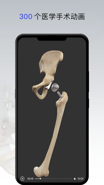 骨科专家手机版 v1.1.0 安卓最新版0