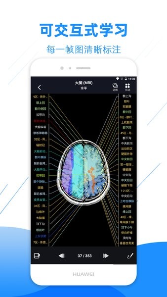 医学影像解剖图谱 v3.1.3 安卓版0