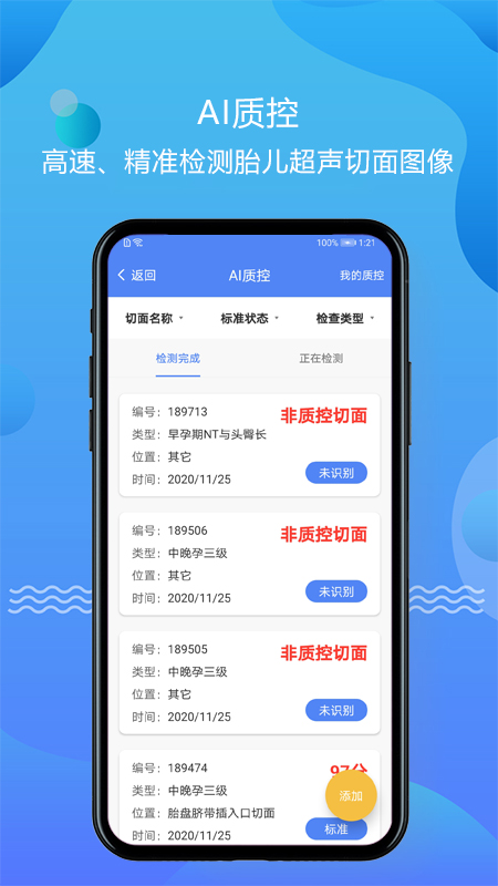 超聲智庫手機版 v1.2.26 2