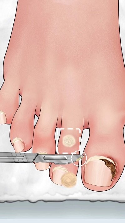 沉浸式修腳大師 v1.0 0